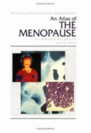 An Atlas of the Menopause - Whitehead, Malcolm I, and Whitcroft, S I J