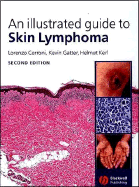 An Illustrated Guide to Skin Lymphoma - Cerroni, Lorenzo, M.D., and Gatter, Kevin, and Kerl, Helmut, M.D.