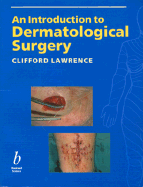 An Introduction to Dermatological Surgery