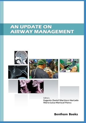 An Update on Airway Management - Mariscal Flores, Mara Luisa, and Martinez-Hurtado, Eugenio Daniel