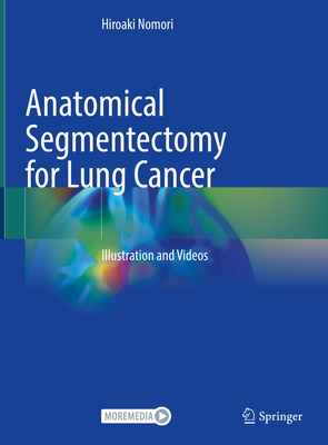 Anatomical Segmentectomy for Lung Cancer: Illustration and Videos - Nomori, Hiroaki