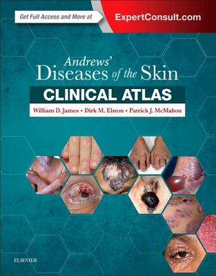 Andrews' Diseases of the Skin Clinical Atlas - James, William D, Col., MD, and Elston, Dirk M, MD, and McMahon, Patrick J, MD