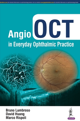 Angio OCT in Everyday Ophthalmic Practice - Lumbroso, Bruno, and Huang, David, and Rispoli, Marco