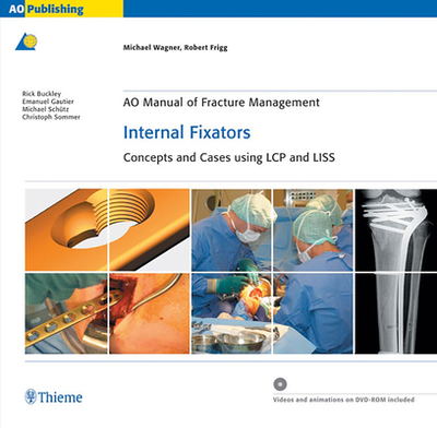 AO Manual of Fracture Management: Internal Fixators: Concepts and Cases Using LCP/LISS - Wagner, Michael, and Frigg, Robert