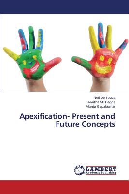 Apexification- Present and Future Concepts - de Souza Neil, and M Hegde Amitha, and Gopakumar Manju