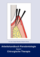 Arbeitshandbuch Parodontologie: Band 2 Chirurgische Therapie