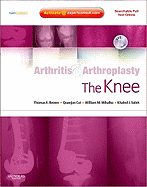 Arthritis and Arthroplasty: The Knee: Expert Consult - Online, Print and DVD