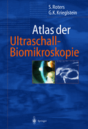 Atlas Der Ultraschall-Biomikroskopie