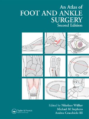 Atlas Foot and Ankle Surgery - Wlker, Nikolaus (Editor), and Stephens, Michael (Editor), and Cracchiolo, Andrea C (Editor)