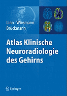 Atlas Klinische Neuroradiologie Des Gehirns