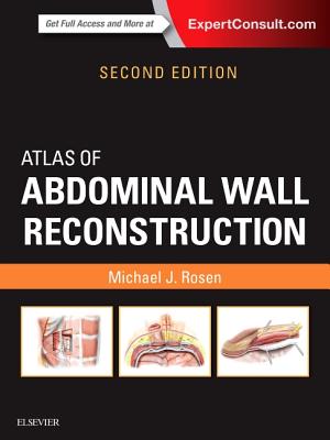 Atlas of Abdominal Wall Reconstruction - Rosen, Michael J, MD, Facs