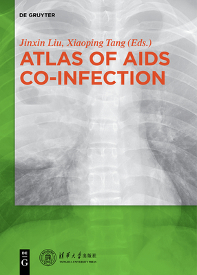 Atlas of AIDS Co-Infection - Jinxin, Liu (Editor), and Xiaoping, Tang (Editor)