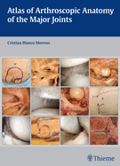 Atlas of Arthroscopic Anatomy of the Major Joints