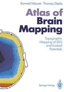 Atlas of Brain Mapping: Topographic Mapping of Eeg and Evoked Potentials - Maurer, Konrad, Dr., Ph.D., and Dierks, Thomas