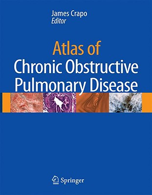 Atlas of Chronic Obstructive Pulmonary Disease - Crapo, James D, MD (Editor)