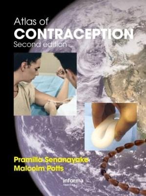 Atlas of Contraception - Senanayake, Pramilla, and Potts, Malcolm