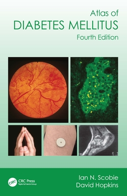 Atlas of Diabetes Mellitus - Scobie, Ian N, and Hopkins, David