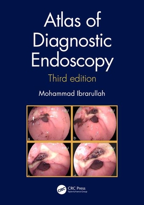 Atlas of Diagnostic Endoscopy - Ibrarullah, Mohammad