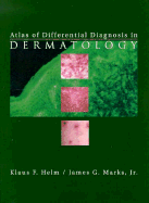 Atlas of Differential Diagnosis in Dermatology