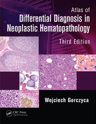 Atlas of Differential Diagnosis in Neoplastic Hematopathology - Gorczyca, Wojciech (Editor)