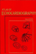 Atlas of Echocardiography