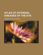 Atlas of External Diseases of the Eye