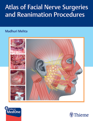 Atlas of Facial Nerve Surgeries and Reanimation Procedures - Mehta, Madhuri (Editor)