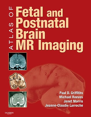 Atlas of Fetal and Postnatal Brain MR - Griffiths, Paul D, and Morris, Janet, Msc, and Larroche, Jeanne-Claudie, MD