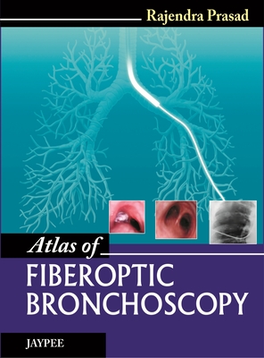 Atlas of Fiberoptic Bronchoscopy - Prasad, Rajendra