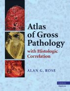 Atlas of Gross Pathology: With Histologic Correlation