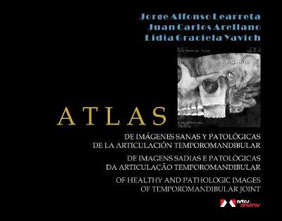 Atlas: Of Healthy and Pathologic Images of Temporomandibular Joint - Learreta, Jorge Alfonso, and Arellano, Juan Carlos, and Yavich, Lidia Graciela