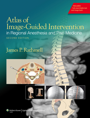 Atlas of Image-Guided Intervention in Regional Anesthesia and Pain Medicine - Rathmell, James P, MD