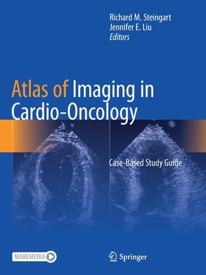 Atlas of Imaging in Cardio-Oncology: Case-Based Study Guide - Steingart, Richard M. (Editor), and Liu, Jennifer E. (Editor)