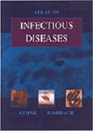 Atlas of Infectious Diseases - Sutton, David, MD, Frcp