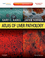 Atlas of Liver Pathology: Expert Consult - Online and Print