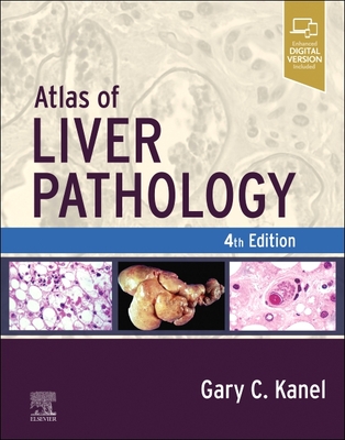 Atlas of Liver Pathology - Kanel, Gary C, MD
