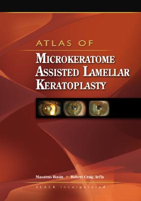 Atlas of Microkeratome Assisted Lamellar Keratoplasty - Busin, Massimo, and Arffa, Robert Craig, MD