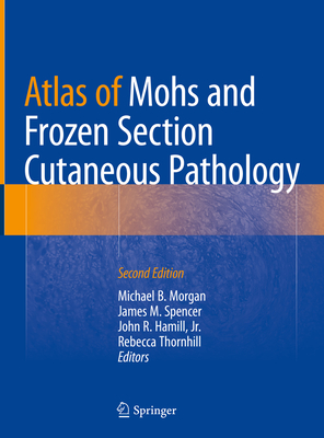 Atlas of Mohs and Frozen Section Cutaneous Pathology - Morgan, Michael B (Editor), and Spencer, James M (Editor), and Hamill Jr, John R (Editor)