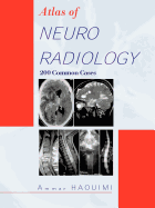 Atlas of Neuroradiology: 200 Common Cases
