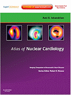 Atlas of Nuclear Cardiology: Imaging Companion to Braunwald's Heart Disease: Expert Consult - Online and Print