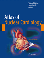 Atlas of Nuclear Cardiology