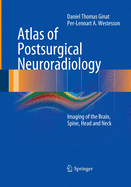 Atlas of Postsurgical Neuroradiology: Imaging of the Brain, Spine, Head, and Neck