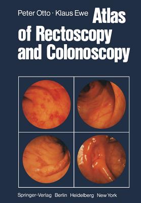 Atlas of Rectoscopy and Coloscopy - Otto, P, and Clowdus, B (Translated by), and Ewe, K