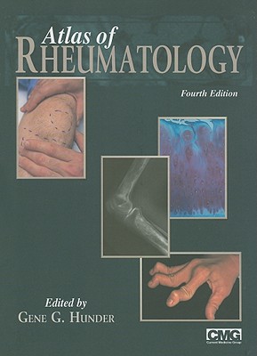 Atlas of Rheumatology - Hunder, Gene G, M.D. (Editor)