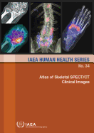 Atlas of Skeletal SPECT/CT Clinical Images