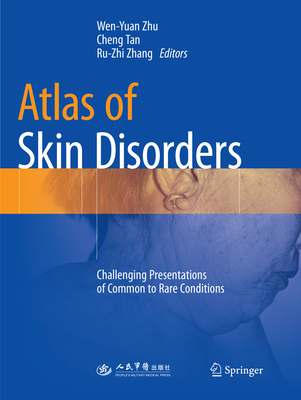 Atlas of Skin Disorders: Challenging Presentations of Common to Rare Conditions - Zhu, Wen-Yuan (Editor), and Tan, Cheng (Editor), and Zhang, Ru-zhi (Editor)