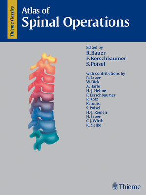 Atlas of Spinal Operations - Bauer, R (Editor), and Kerschbaumer, Fridun (Editor), and Poisel, S (Editor)