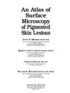 Atlas of Surface Microscopy of Pigmented Skin Lesions - Menzies, Scott W, and McCarthy, W H, and Ingvar, Christian