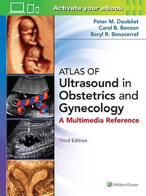 Atlas of Ultrasound in Obstetrics and Gynecology - Doubilet, Peter M., and Benson, Carol B., MD, and Benacerraf, Beryl R.
