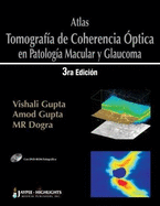 Atlas - Tomografia de Coherencia Optica en Patologia Macular y Glaucoma